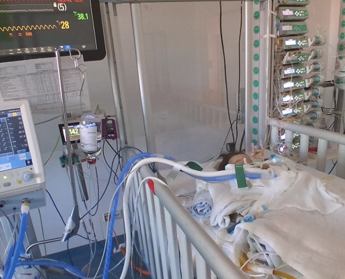 Első átültetés után az intenzív osztályon